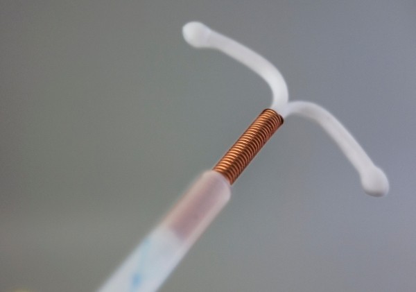 ห่วงอนามัยทองแดง (IUD หรือ IUS)